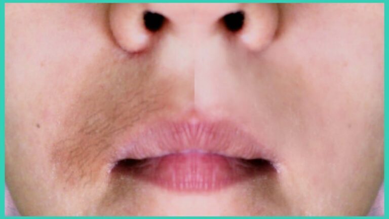 Consejos para eliminar las manchas del bigote
